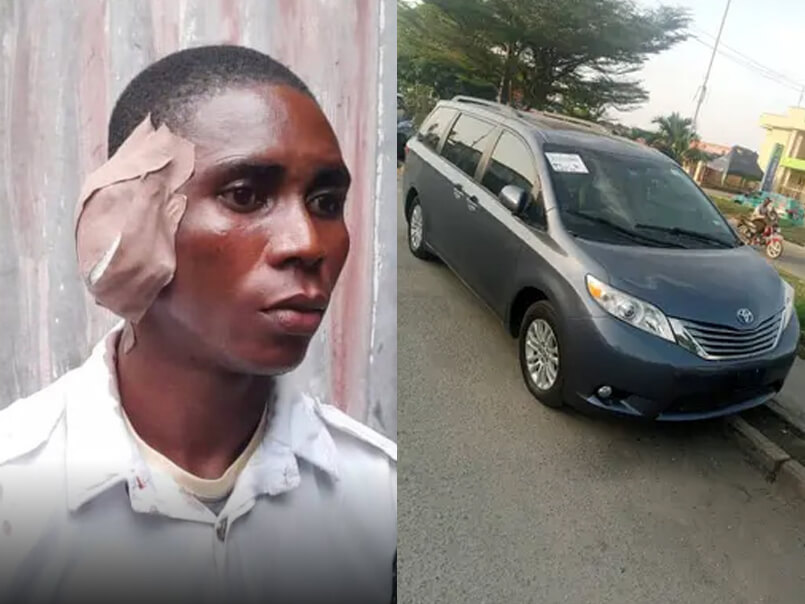 Sienna Drivers Bites Off VIO Officer’s Ear Over Expired Vehicle Papers 